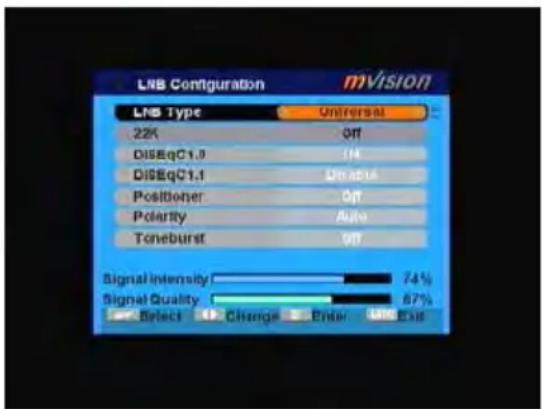 MVision HD-100S - TP Scan - 2