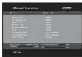 MVision HD-300N - e) Motor Movement - 4