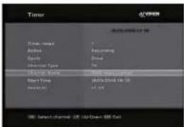 MVision HD-300N - Aanbevolen Medium - 1
