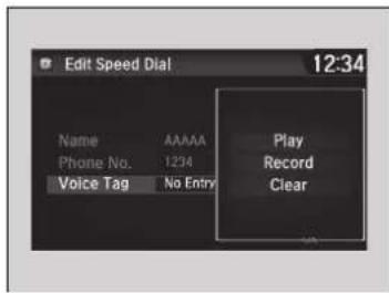 Acura NSX (2020) - >>Speed Dial - 2
