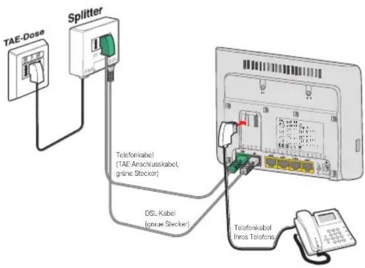 T-Mobile Speedport W 504V - Analoge Telefone anschließen - 1