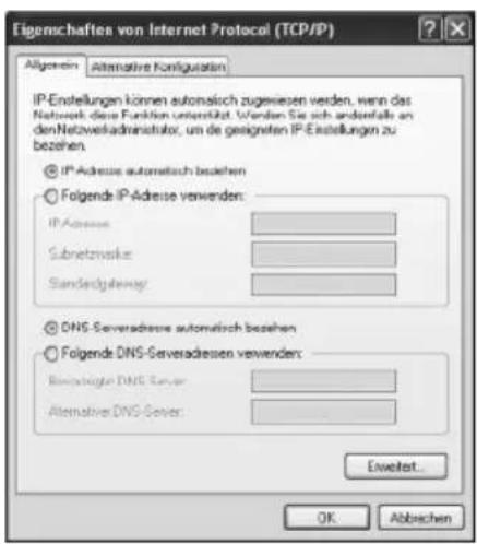 T-Mobile Speedport W 504V - Automatisches Beziehen der IP-Adresse einstellen - 2