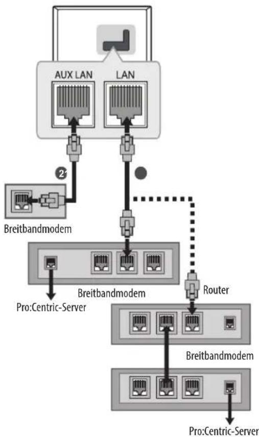 LG 55UU661H - Kabelgebundene Netzwerkverbindung - 1