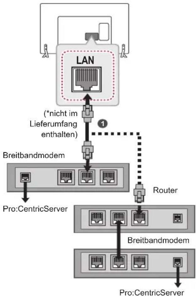 LG 32LW760H - VORSICHT - 1