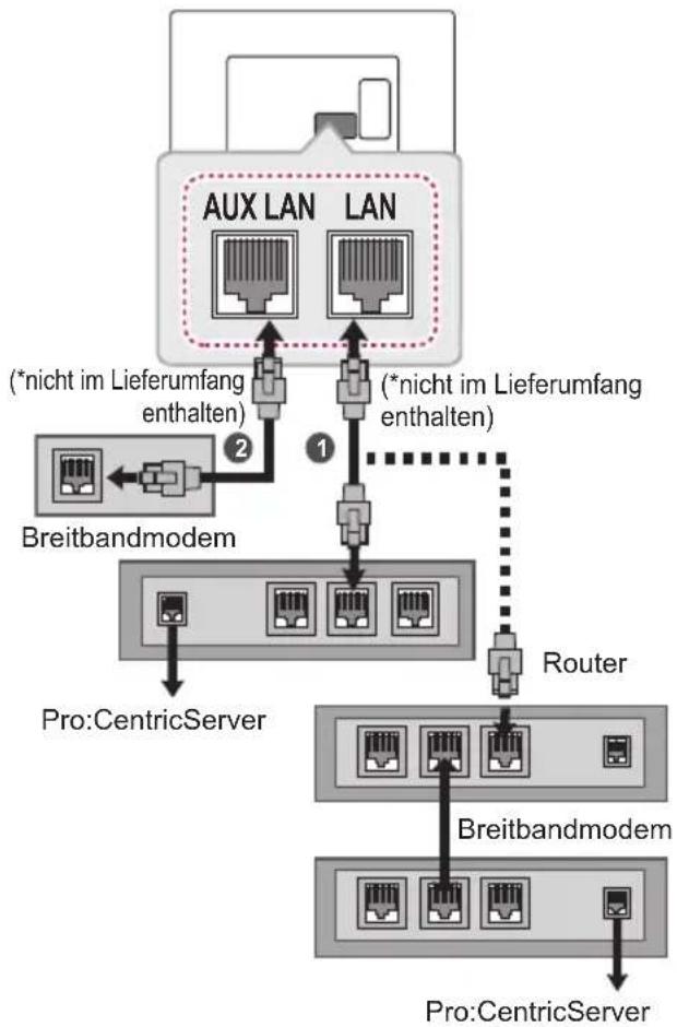 LG 32LW760H - VORSICHT - 2