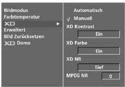 LG 42LT76 - XD - BILDVERBESSERUNGSTECHNOLOGIE - 3