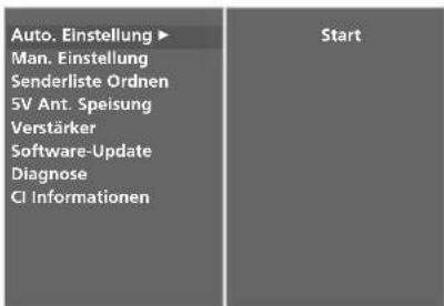 LG 42LT76 - AUTOMATISCHE PROGRAMMIERUNG (IM DIGITALMODUS) - 3