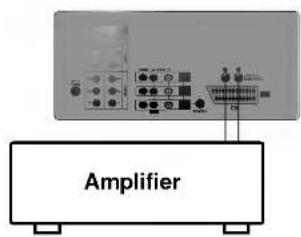 Amplifier