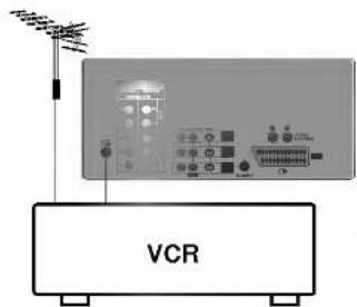 VCR