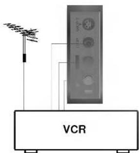 VCR