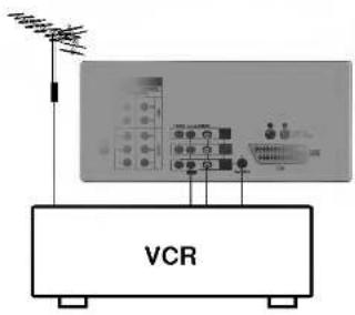 VCR