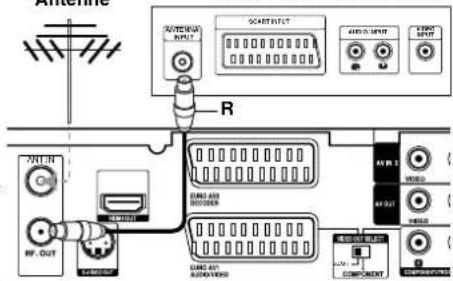 LG LH-WH7695IA - RF-Koaxial-Anschluss - 1