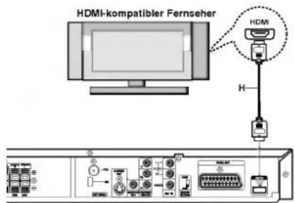 LG LH-T7654PA - Über HDMI - 1