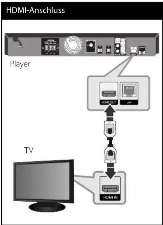 LG HB44A - HDMI-Anschluss - 1