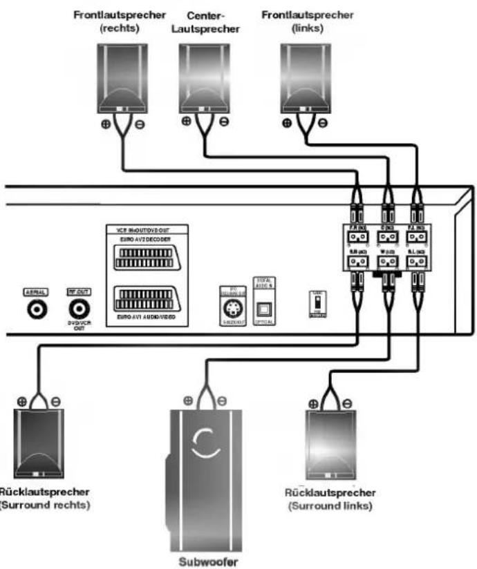 LG DT-585GP - Anmerkungen - 2