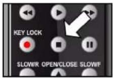 MEDION LIFE P71014 (MD 83533) - ■ (STOP) - 1