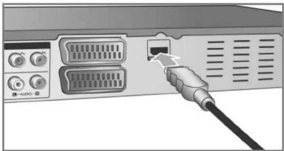 MEDION LIFE X70001 (MD 83200) - HDMI-Anschluss - 1