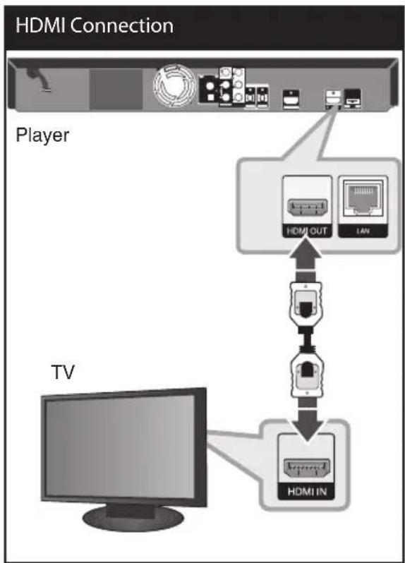 LG LHB335 - HDMI Connection - 1