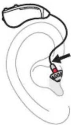 BOSE SoundControl Hearing Aids - To remove the hearing aids - 1