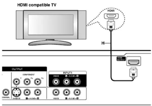 LG RC897T - Connections to your TV (HDMI) - 1