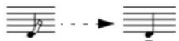 STEINBERG Cubase Studio 5 - Adding a symbol to one note - 1