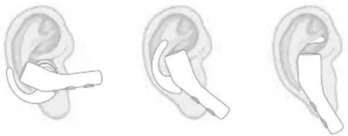 Treblab X5 - Fitment advise - 1