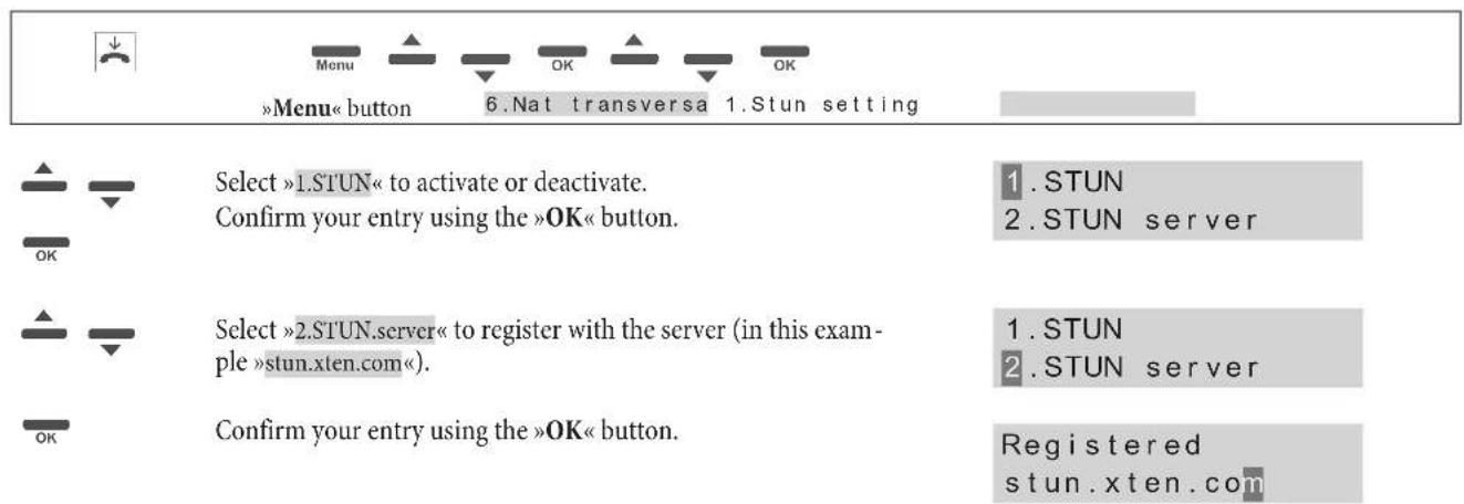 Funkwerk IP50 - STUN Setting - 1