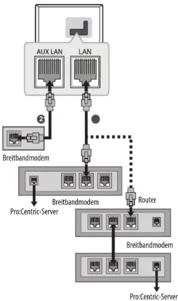 LG 65WS960H0ZD - Kabelgebundene Netzwerkverbindung - 1