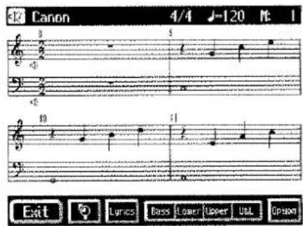 Canon 4/4 J-120 M: 1 Exit Lyrics Bass Flower Topper Det Option