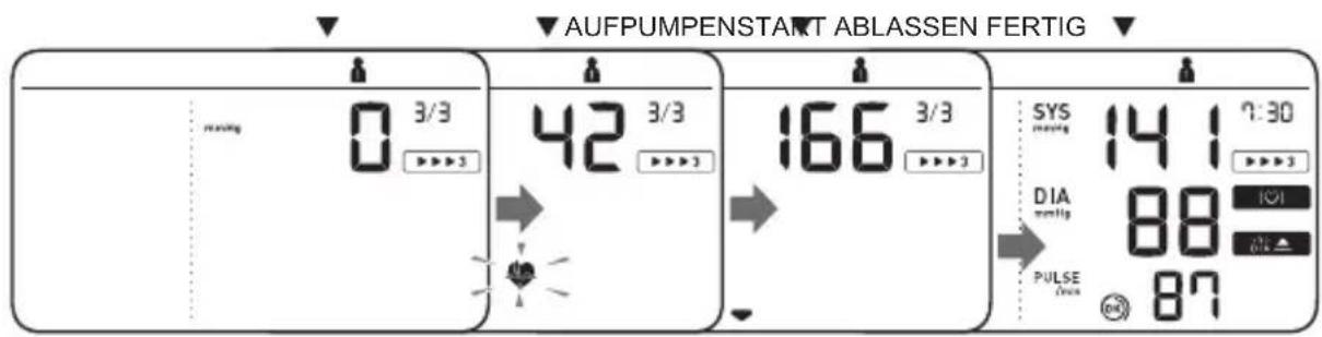 AUFPUMPENSTART ABLASSEN FERTIG 0 3/3 42 3/3 166 3/3 SYS 14 1 7:30 DIA 88 PULSE 87