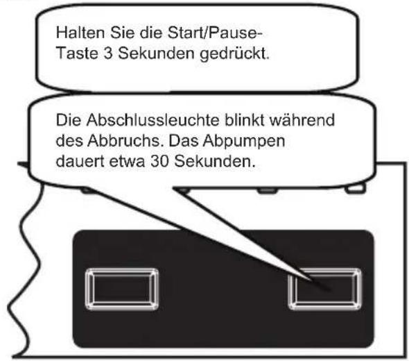 Halten Sie die Start/Pause-Taste 3 Sekunden gedrückt. Die Abschlussleuchte blinkt während des Abbruchs. Das Abpumpen dauert etwa 30 Sekunden.