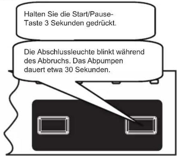 Halten Sie die Start/Pause-Taste 3 Sekunden gedrückt. Die Abschlussleuchte blinkt während des Abbruchs. Das Abpumpen dauert etwa 30 Sekunden.