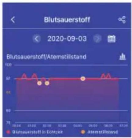 Blutsauerstoff | Date | Blutsauerstoff in Echzek | Atemstillstand | |---|---|---| | 09.06 | 97 | 97 | | 11.06 | 97 | 95 | | 12.08 | 97 | 95 | | 04.00 | 97 | 97 | | 06.03 | 97 | 97 | | 07.14 | 97 | 97 |