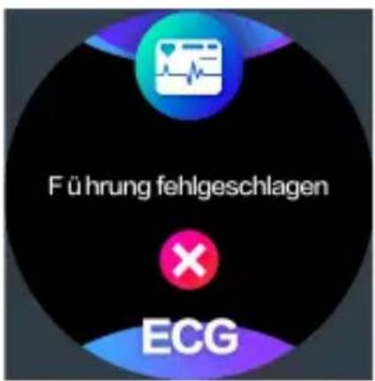 F ü hrung fehlgeschlagen ECG