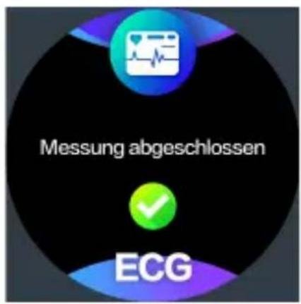 Messung abgeschlossen ECG
