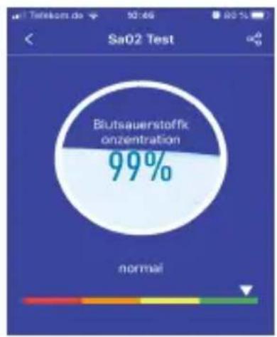 | Category | Value | | -------- | ----- | | Biutsauerstoffk oncentration | 99% |