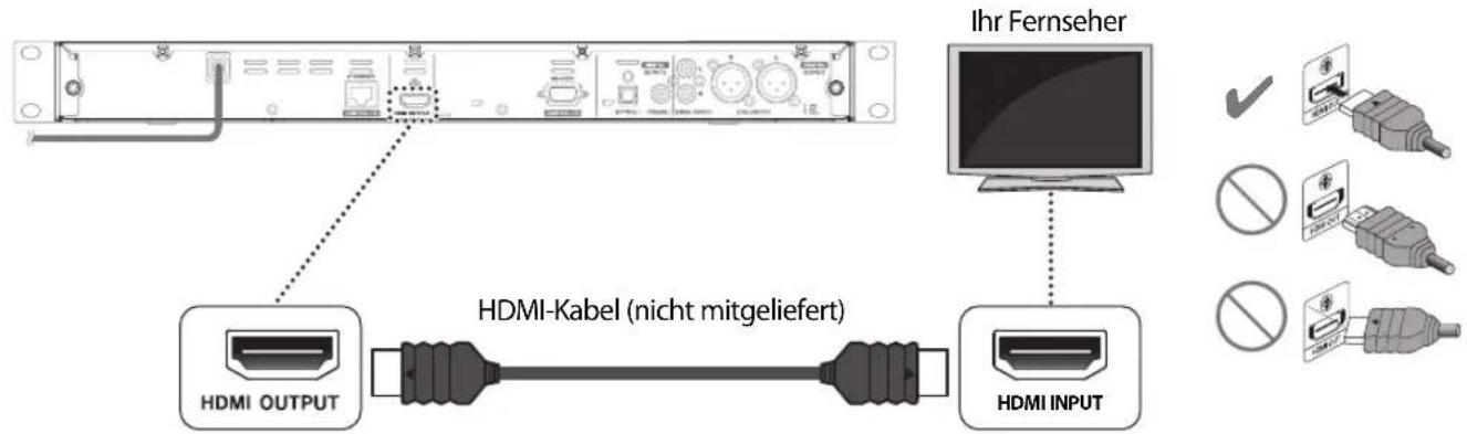 Ihr Fernseher HDMI-Kabel (nicht mitgeliefert) HDMI OUTPUT HDMI INPUT