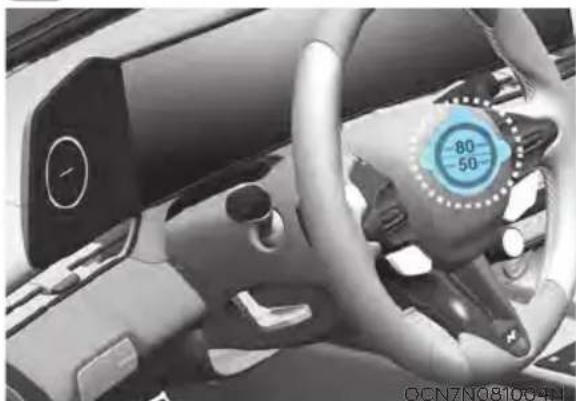 HYUNDAI Elantra N (2022) - CAUTION - 1