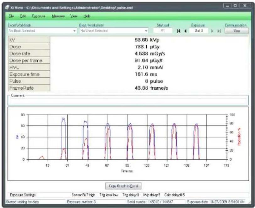 RaySafe Solo - RAYSAFE Xi VIEW - 1