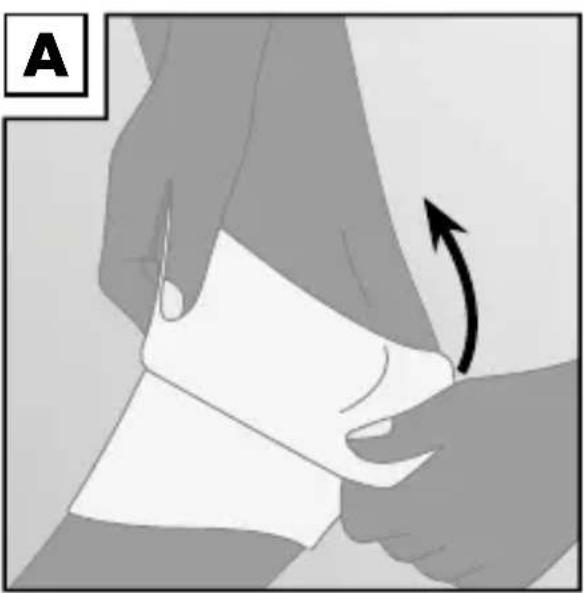 Sensiplast IAN 113152 - Applying the brace - 1