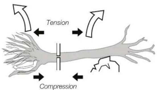 Tension Compression
