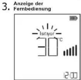 3. Anzeige der Fernbedienung -1870V 30°C 12:00