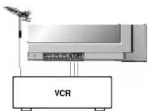VCR