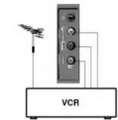 VCR