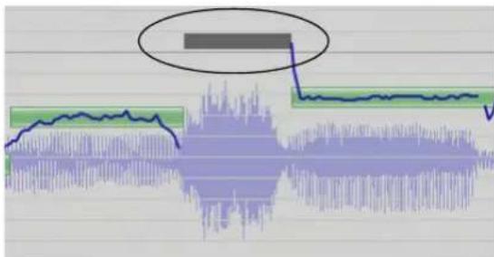 Audio waveform image with overlaid green and blue signal lines, highlighting a specific audio peak in the gray oval.