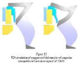 Figure 11 FCA stimulation of exaggerated deformation of cytokine exaggeration and accumulation impact of 12 h/yr
