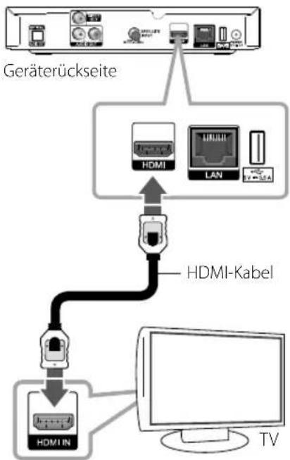 LG TN530V - HDMI-Anschluss - 1
