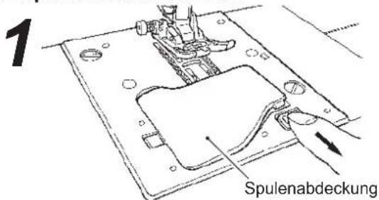 1 Spulenabdeckung