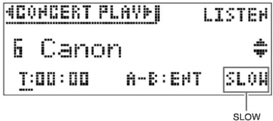 #CONCERT PLAY! LISTEN 6 Canon T:00:00 A-B:EHT SLOW SLOW