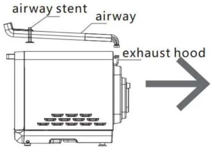 airway stent airway exhaust hood